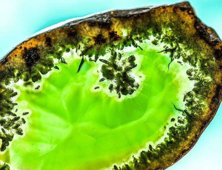 LABORDIAGNOSTIK OHNE BLUTENTNAHME -  - 2017-10-01